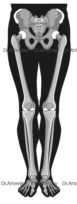 Идеальная форма ног предполагает наличие трех промежутков при смыкании коленных суставов, голеней (икр) и лодыжек.